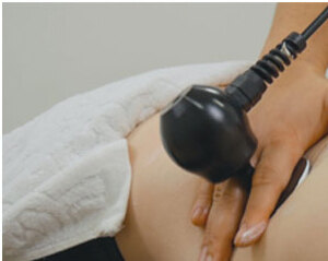 WINBACK Tecartherapy handpiece delivering radiofrequency treatment